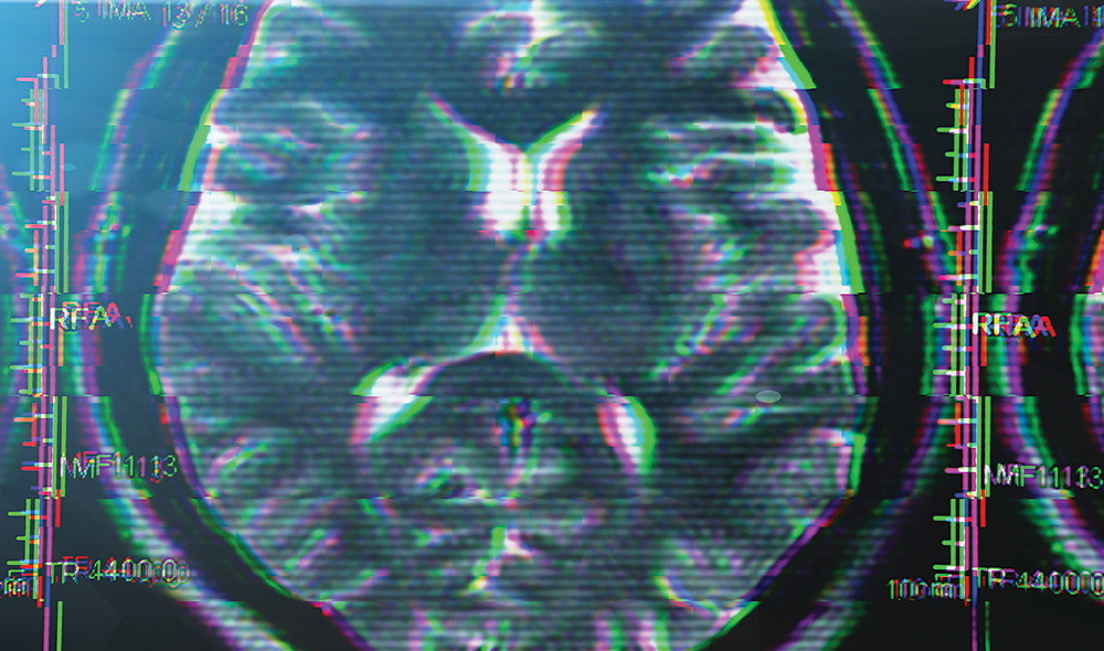 Image of a brainscan